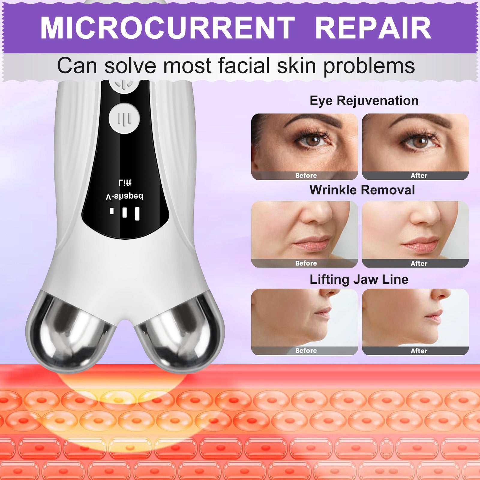 HY113 Microcurrent Facial Lifting Roller with Red Light