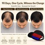 LED Photon Hair Cap – Red/Blue Light