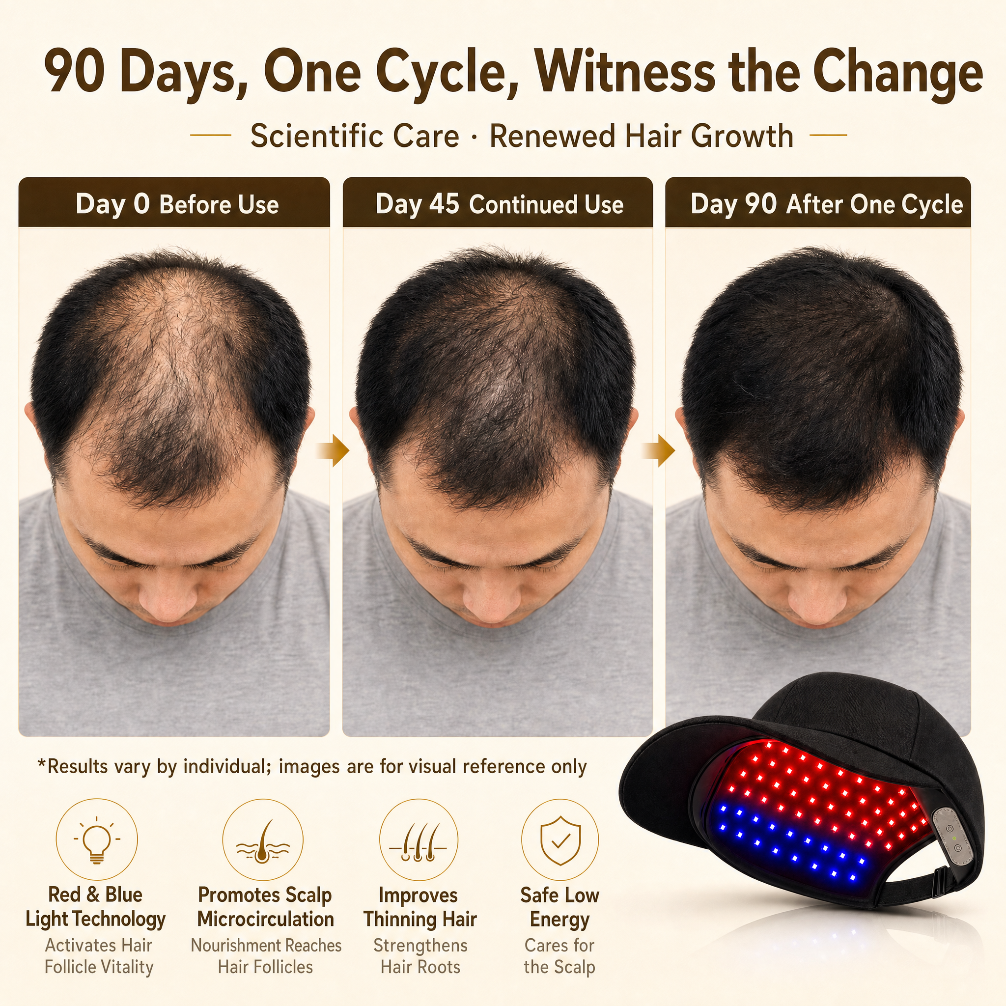LED Photon Hair Cap – Red/Blue Light, USB-C, Lightweight